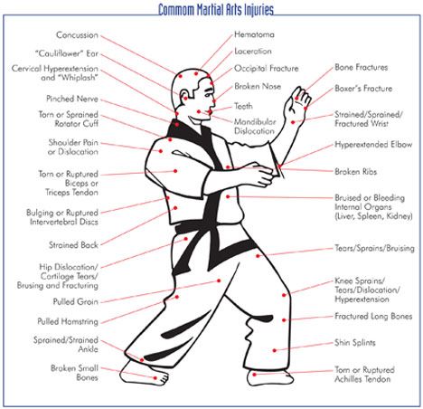 Martial Arts Pressure Points Chart